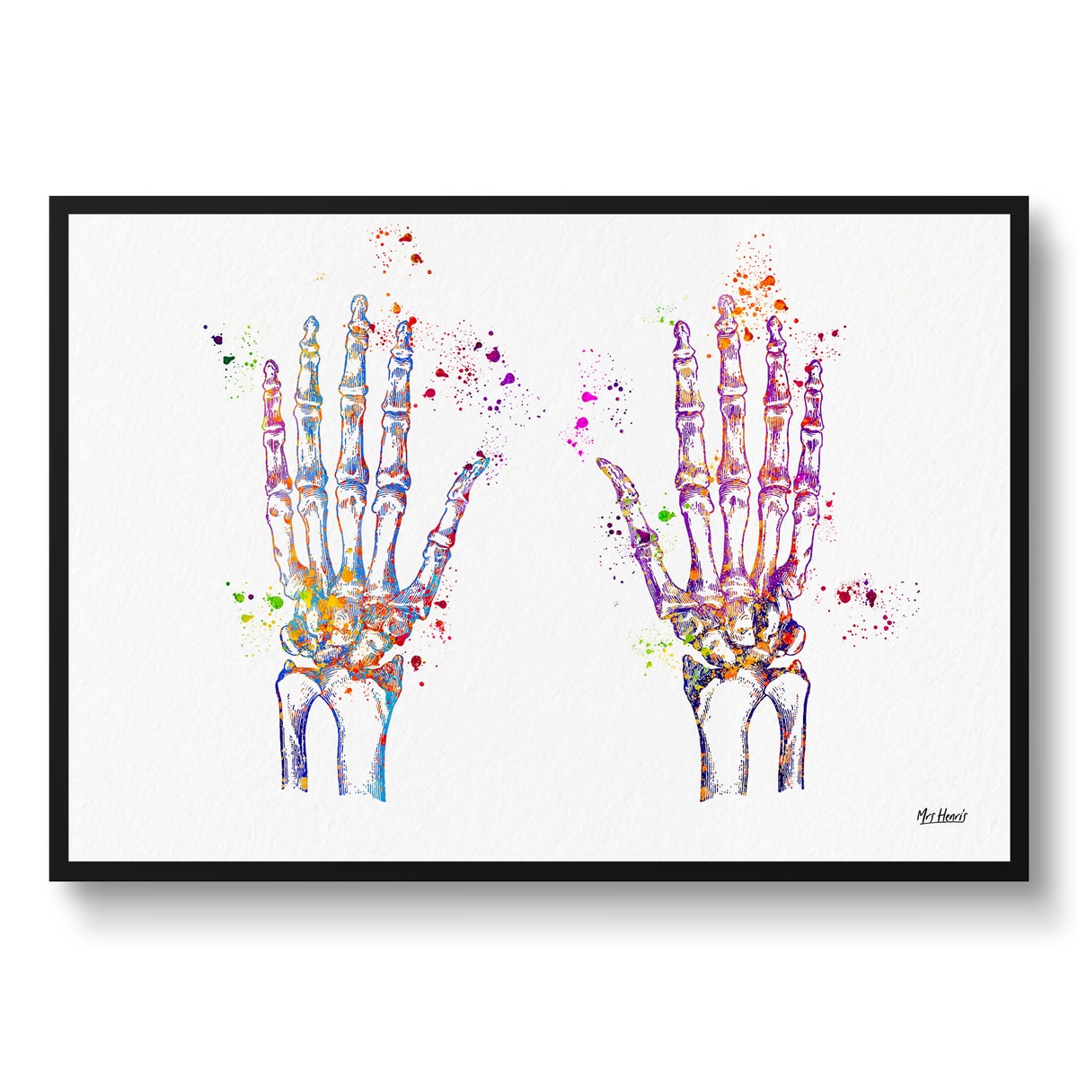 Hand Bones Anatomy Watercolour Print Hand Surgeon Medical Doctor Office Clinic Wall Art 3 Hand Bones Anatomy Watercolour Print Hand Surgeon Medical Doctor Office Clinic Wall Art