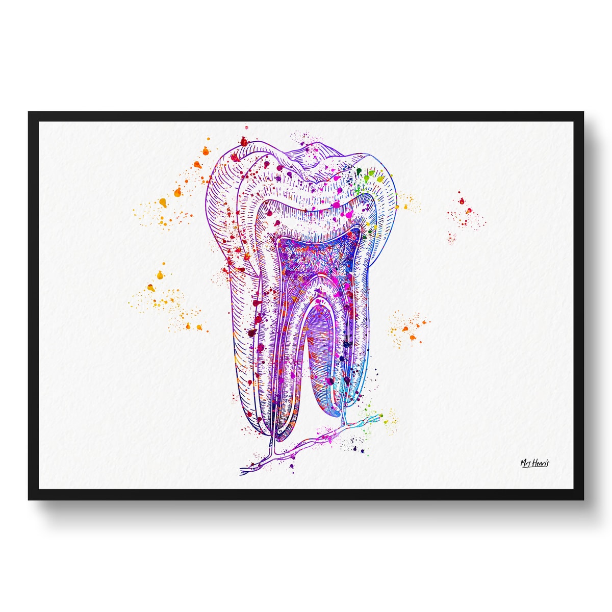 Tooth Structure Watercolour Print Tooth Cross Section Anatomy Dental Office Clinic Wall Art 2 Tooth Structure Watercolour Print Tooth Cross Section Anatomy Dental Office Clinic Wall Art